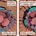 The location and differentiation of quiescent and activated hepatic stellate cells
